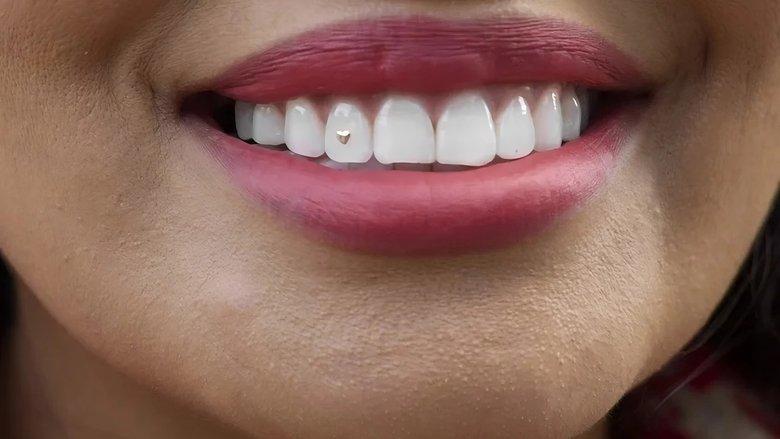 Open Wide image